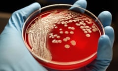 MRSA colonies on blood agar plate