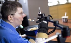 Bill Kochevar, who was paralysed eight years ago, but has regained some control of his arm thanks to neuroprosthetics.