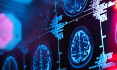 Human brain scan in a neurology clinic.
