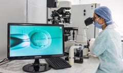 Technician using a light microscope to inject human sperm into a human egg cell (ovum) during in vitro fertilisation (IVF), This technique is known as intracytoplasmic sperm injection (ICSI).