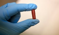 A Faecal Microbiota Transplant (FMT) capsule.