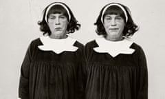 When you’re twinning, you’re winning … Sandro Miller’s photograph of John Malkovich, a tribute to the work of Diane Arbus.