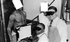 An African American man being X-rayed for the racist, government-funded Tuskegee experiment