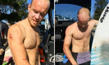 ‘I just punched it in the face’: Surfer describes fending off shark – video