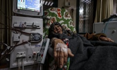 A Palestinian women receiving dialysis treatment is being deprived from the necessary treatments due to the electricity crisis and lack of medication at the Al-Aqsa Martyrs Hospital as the Israeli attacks continue in Deir Al Balah, Gaza on February 8, 2024