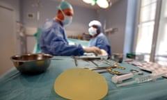 A defective silicone gel breast implant, after it has been removed from a patient in France.