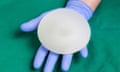 A silicone breast implant