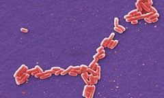 A colorized 2006 scanning electron microscope image made available by the Centers for Disease Control and Prevention shows E. coli bacteria of the O157:H7 strain