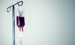 Human blood in a plastic intravenous drip bag, 