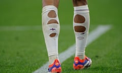 Close-up of Jude Bellingham's wearing socks with three holes ripped down the back