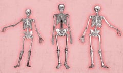 Illustration shows three medical sketches of skeletons in various postures on a pink background