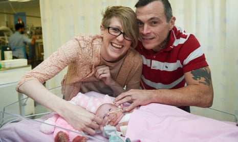 Baby survives after being born with heart outside her body - video