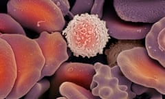 Blood cells, SEM<br>Blood cells. Coloured scanning electron micrograph (SEM) of red blood cells and one white blood cell (upper centre). Red blood cells (erythrocytes) are responsible for carrying oxygen around the body, and for carrying waste carbon dioxide to the lungs for exhalation. White blood cells (leucocytes) are part of the immune system, which protects the body from invading micro-organisms. Magnification: x5000 when printed 10cm wide.