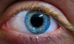 Close-up picture of an eye