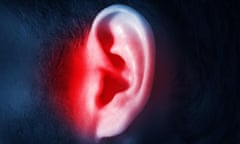human male ear on a dark background isolated<br>KCMDRE human male ear on a dark background isolated