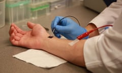 Researchers demonstrate a process known as tissue nanotransfection at The Ohio State University Wexner Medical Center. In laboratory tests, this process was able to heal the badly injured legs of mice in just three weeks with a single touch of this chip. The technology works by converting normal skin cells into vascular cells, which helped heal the wounds.