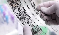 Genetic Research, Scientist holding a DNA gel revealing, the genetic make-up of the specimen