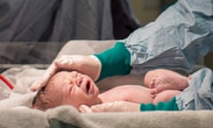 A newborn baby boy is checked by nurses,