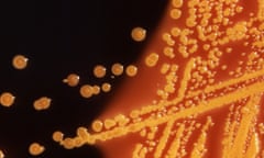 E coli bacteria