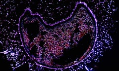 Human colonic specimen<br>CNTTR9 Human colonic specimen