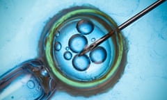 Microscope image of IVF procedure