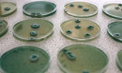 Ordinary yeast cells being cultured in a lab. Although the breakthrough is exciting, currently it would take 20,000 litres of the GM years cells to make one dose of painkiller. 