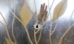 A hospital worker places his hand on a glass door pierced by a bullet hole