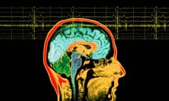 Frame of mind … an EEG reading superimposed over an MRI scan.