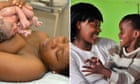 MDG : African Babies, Angel Swartbooi