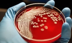 MRSA colonies on blood agar plate