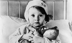 Cecil Beaton's photograph of Eileen Dunne, aged three