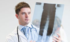 Doctor looking at the x-ray