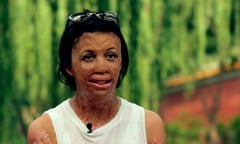 Turia Pitt On The Wall