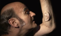 Third ear … Australian performance artist Stelarc has been growing a human ear on his arm for the last nine years.