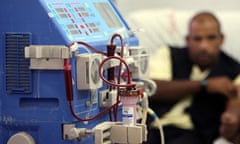 Dialysis treatment