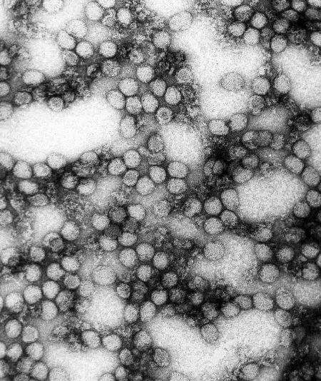 This picture shows multiple 
virions of the yellow fever virus.