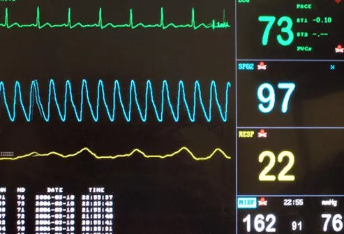 If blood pressure becomes too low, baroreceptors send signals to the heart telling it to beat faster and pump more blood per minute.