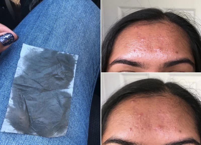 reviewer&#x27;s forehead that appears shiny, and an after photo showing less shiny skin