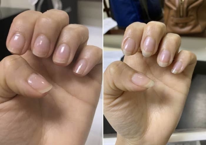 before/after of reviewer&#x27;s nails. the after photo shows longer, healthy looking nails