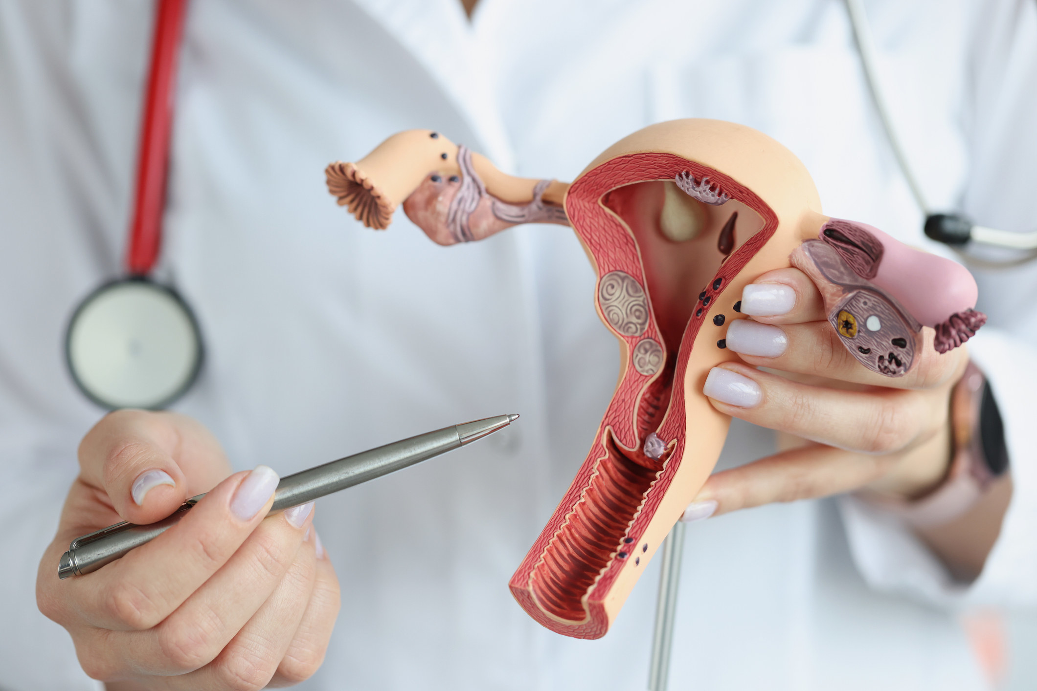 A doctor holding a model of the uterus