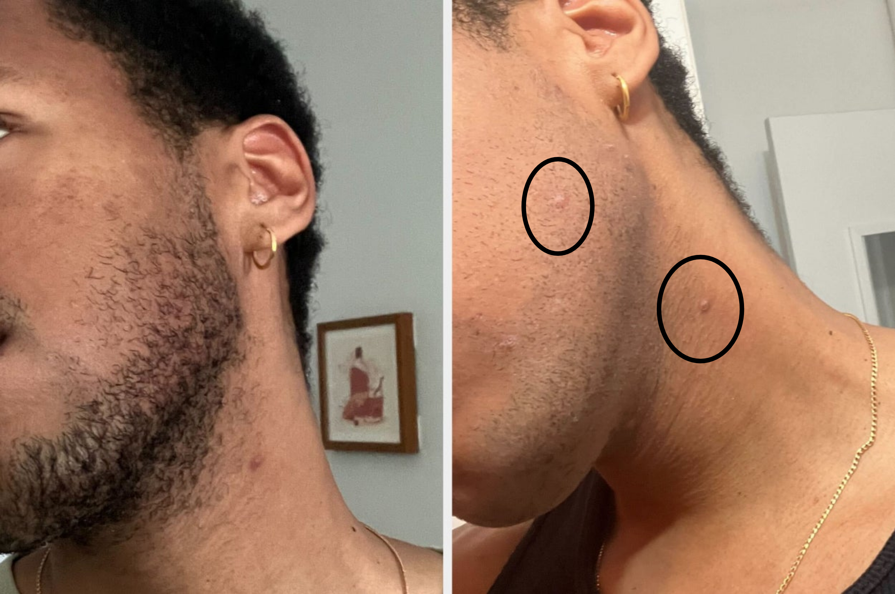 Close-up images showing a person&#x27;s face before and after beard grooming. The left image shows a thicker beard, while the right image shows a well-trimmed beard