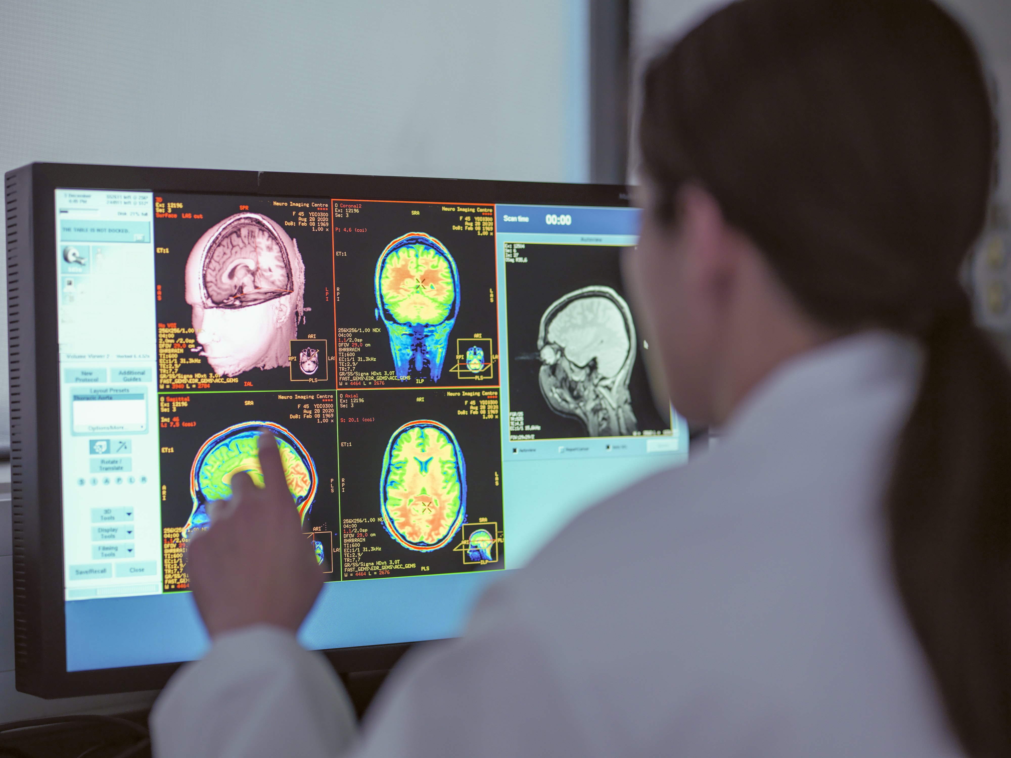 A person in a lab coat examines brain scan images on a computer monitor with various sections of the brain highlighted