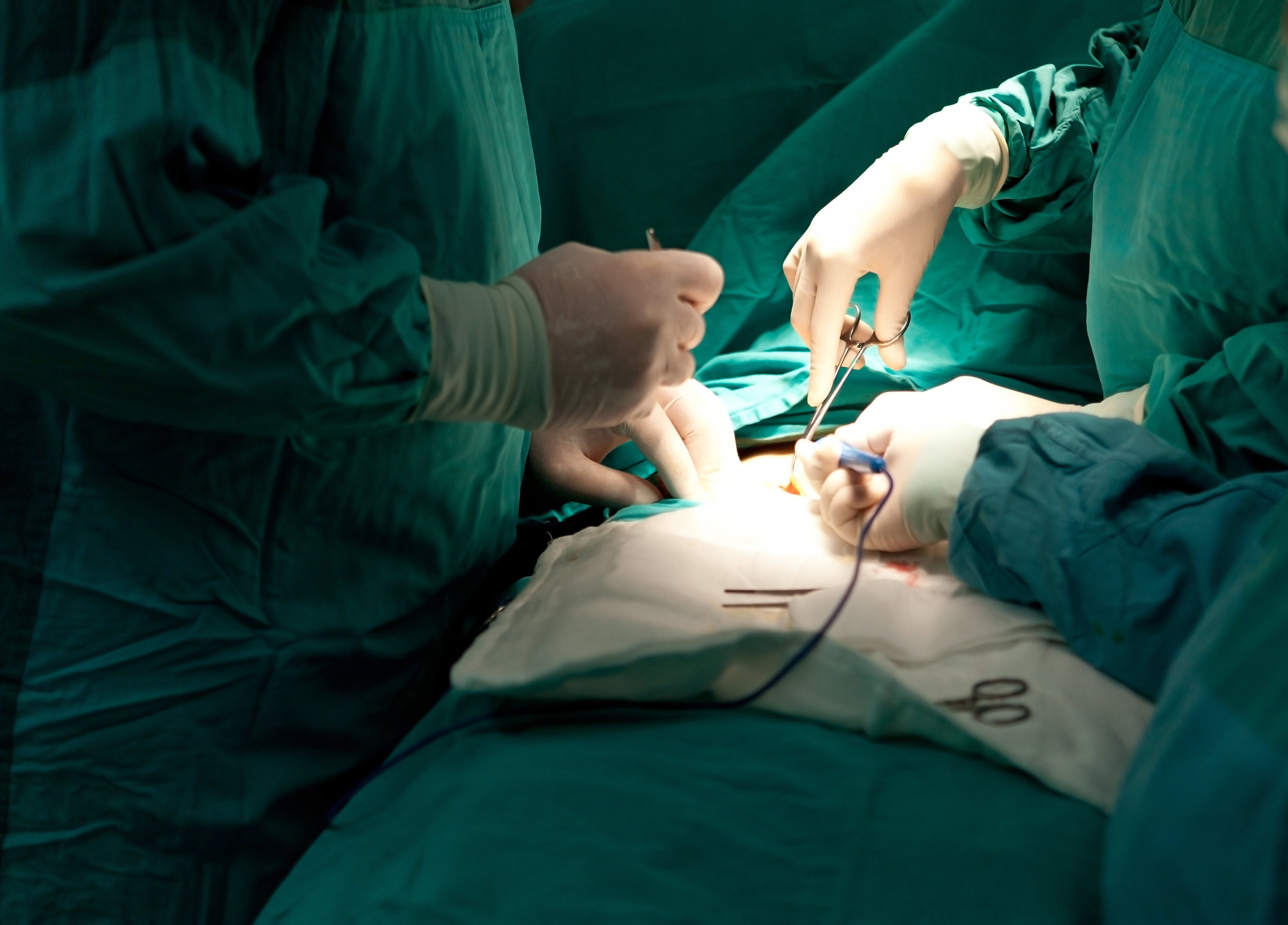 Doctors perform surgery on a patient, focusing on the incision area with various surgical instruments in use