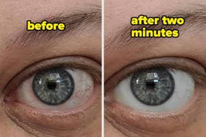 Close-up of a person's eye. The left image shows "before" and the right image shows "after two minutes," highlighting an eye care product's effect