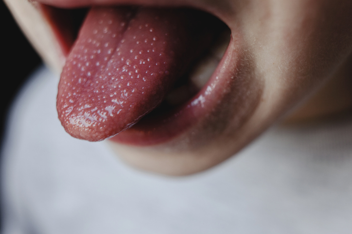 Close-up photo of a child&#x27;s tongue sticking out