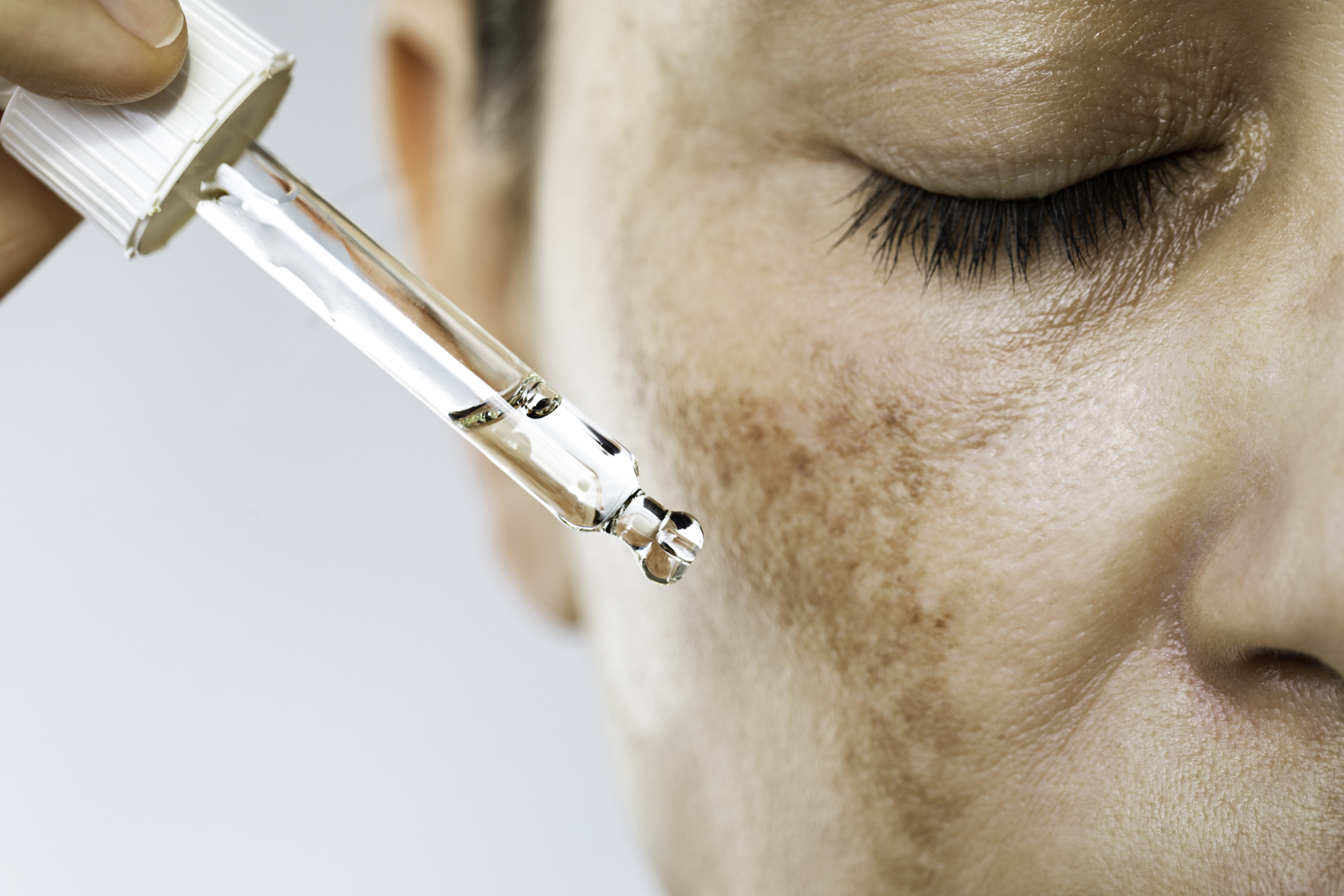 Close-up of a person&#x27;s face with freckles or pigmentation spots, as they use a dropper to apply skincare serum to their cheeks