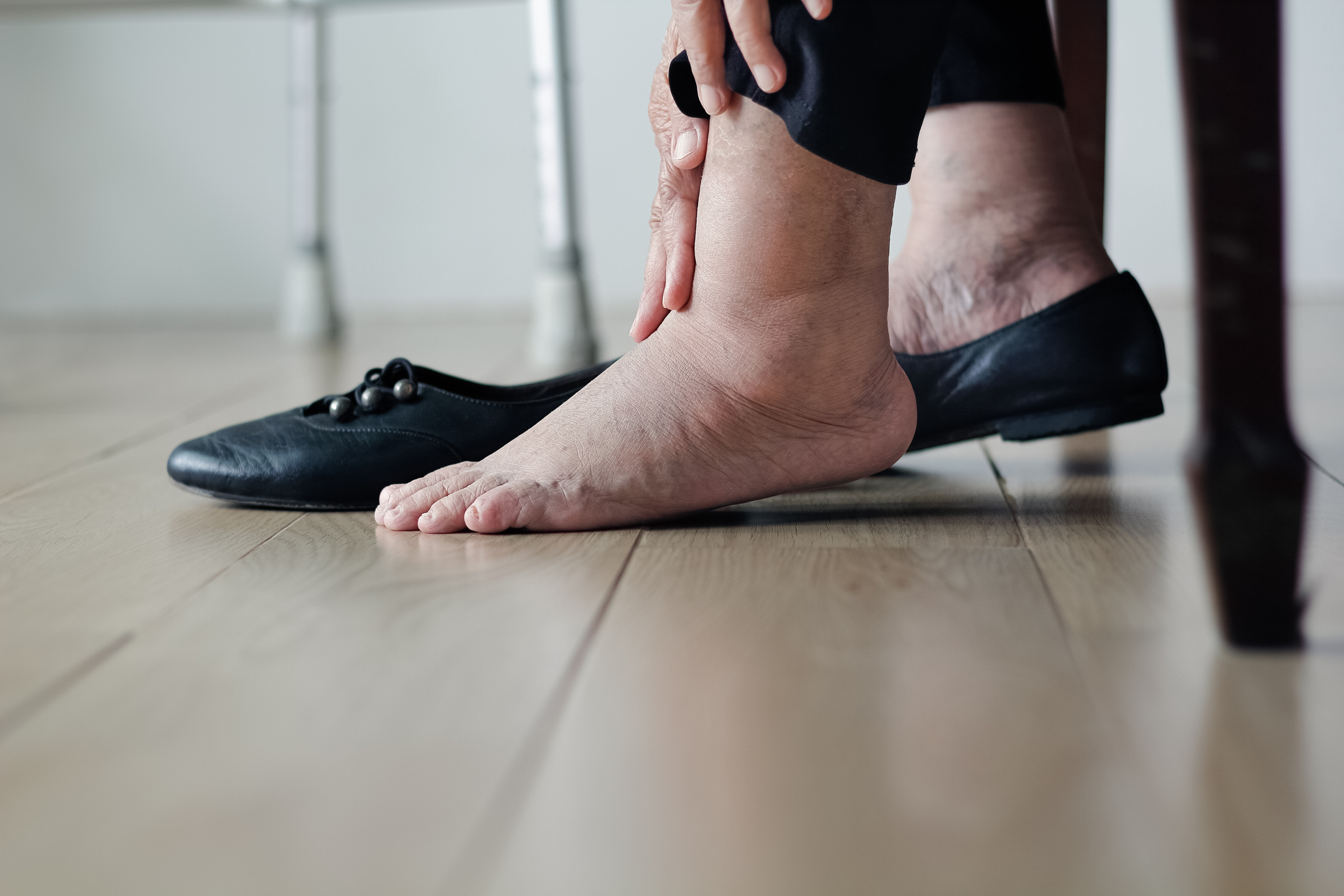 A person is holding their swollen ankle and foot, with one black flat shoe on the floor beside them. The person is seated and appears to be in discomfort