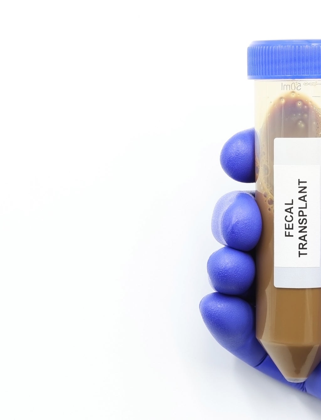 A gloved hand holding a medical vial labeled &quot;Fecal Transplant.&quot;