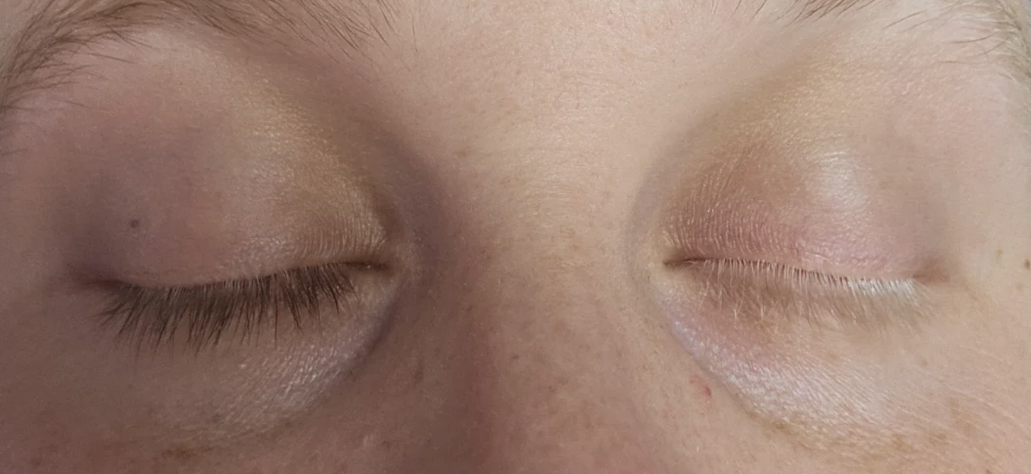 A close-up image of a person&#x27;s closed eyes, showing their eyelashes and the skin around their eyes