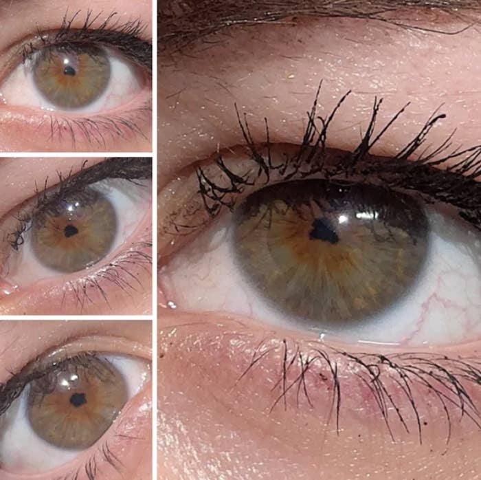 Close-up collage of a person&#x27;s eyes showing detailed views of the iris, eyelashes, and surrounding skin